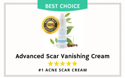 The Best Acne Scar Treatments 🇦🇺